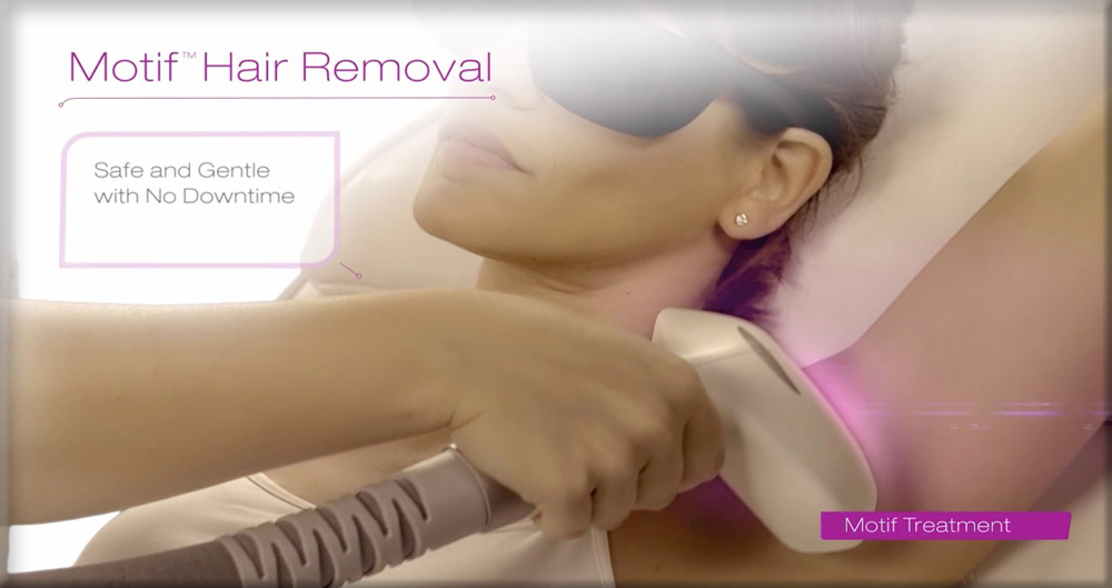 elos laser hair removal